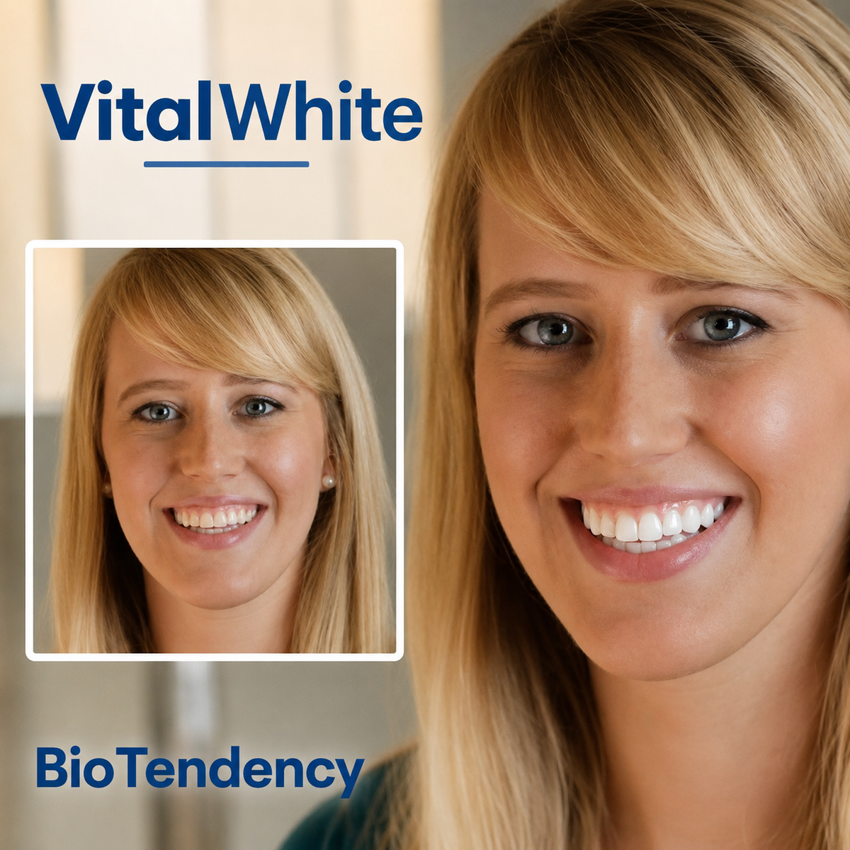 VitalWhite: dientes 8 tonos más blancos en 20 minutos